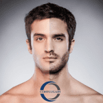 Minoxidil 5% Conflugain - Traitement Repousse Cheveux, Barbe Homme – Image 2